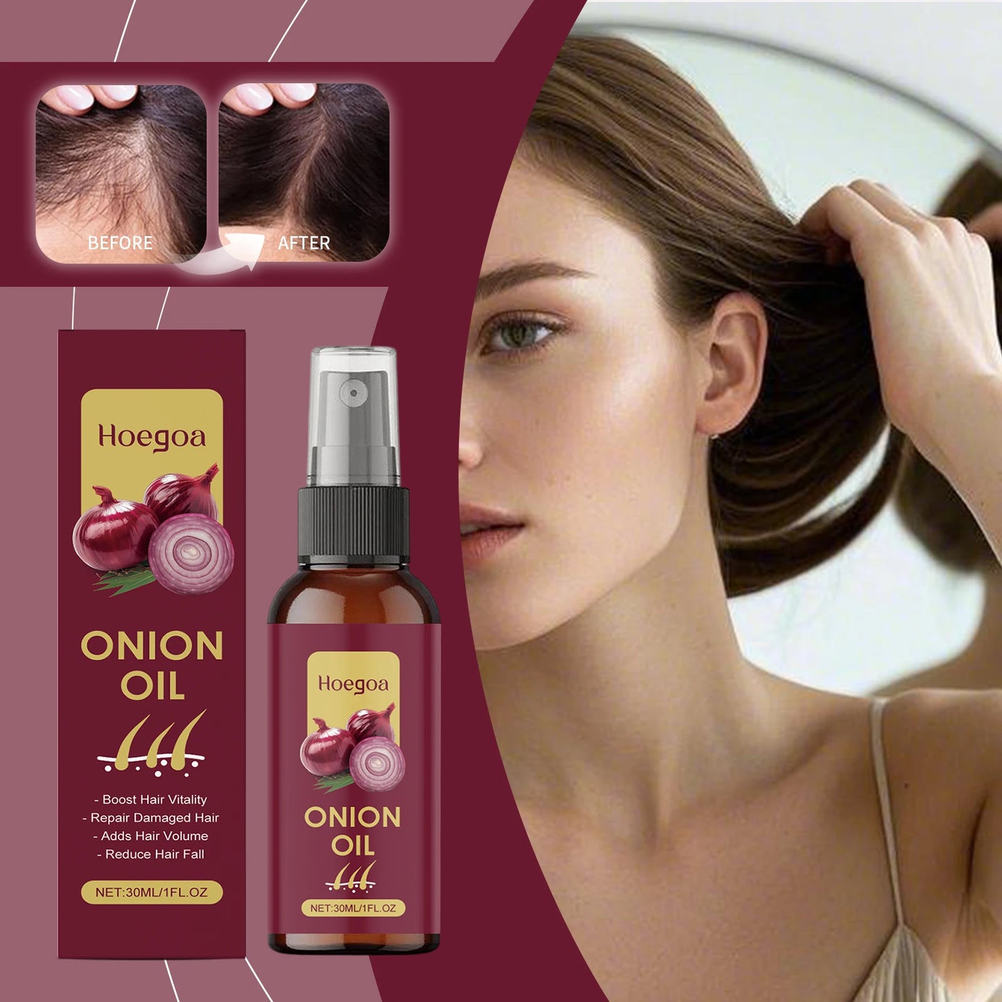 Red Onion Hair Growth Serum Prevent Hair Loss Scalp Treatment Improve Alopecia Strengthening Anti Dry Frizz Red Onion Essential
