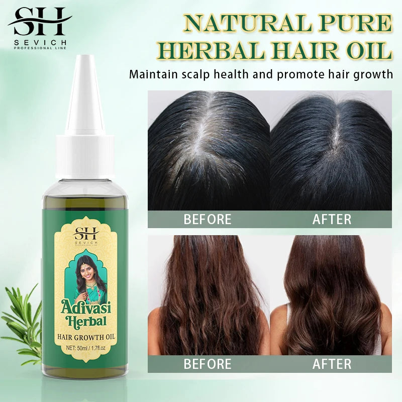Ayurvedic Hair Growth Oil Adivasi Organic Hair Growth Serum Pure Plant Hair Growth Oil Anti Hair Loss Fast Regrowth Haircare