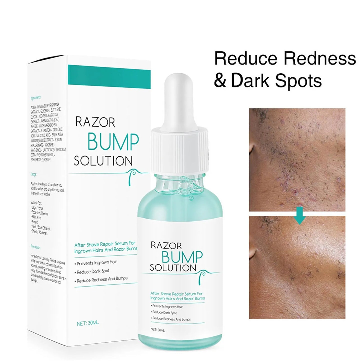 Anti-Ingrown Hair Gentle Serum 30ml Repaired Serum Redness Bumps Ingrown Hair After Shaving Prevent Hair Growth Serum Post-Shave