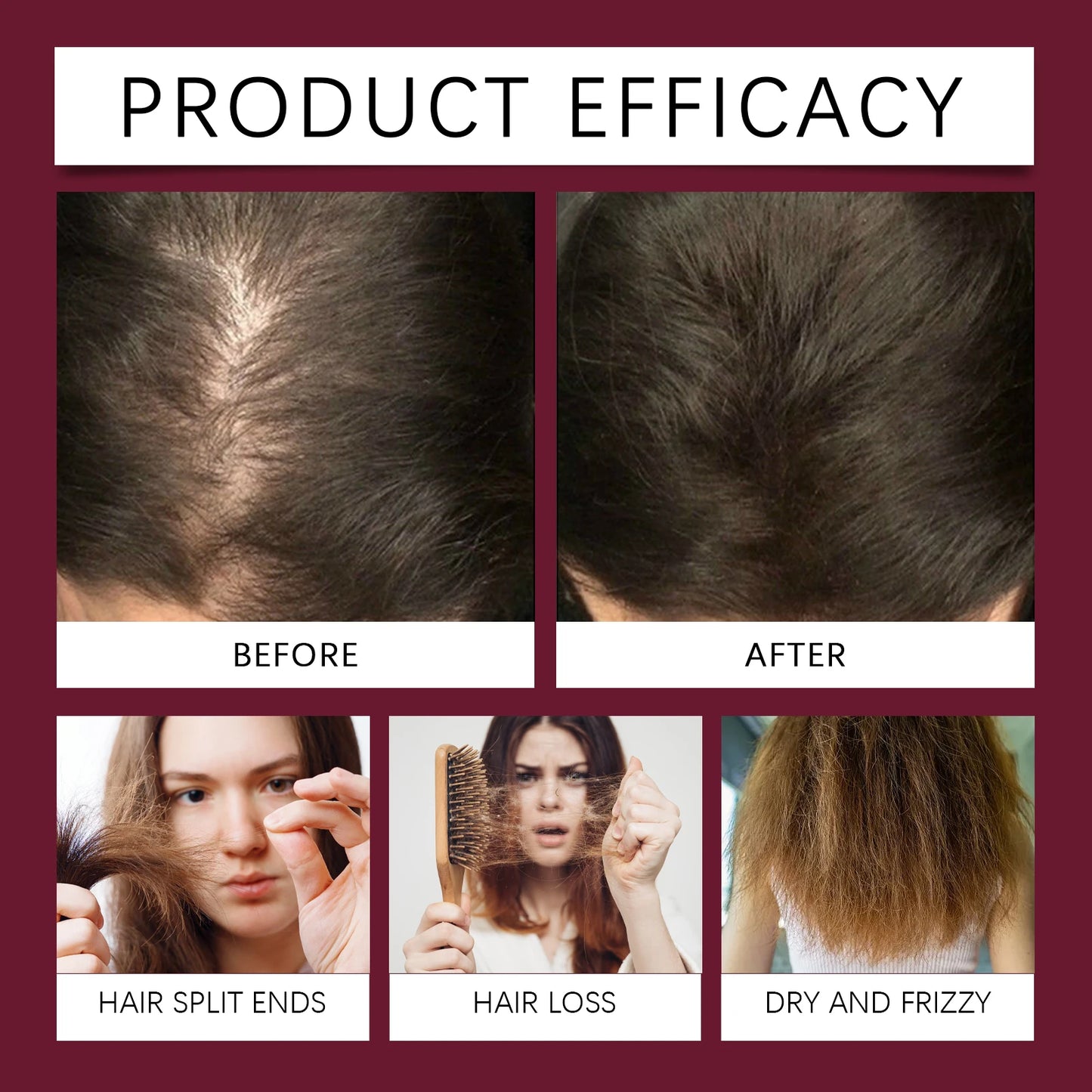 Red Onion Hair Growth Serum Prevent Hair Loss Scalp Treatment Improve Alopecia Strengthening Anti Dry Frizz Red Onion Essential