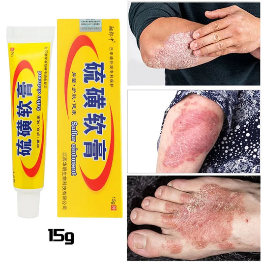 Sulfur Antibacterial Cream Soap Spray Set Psoriasis Eczema Anti-itch Relief Rash Urticaria Desquamation Ointment Body Skin Care