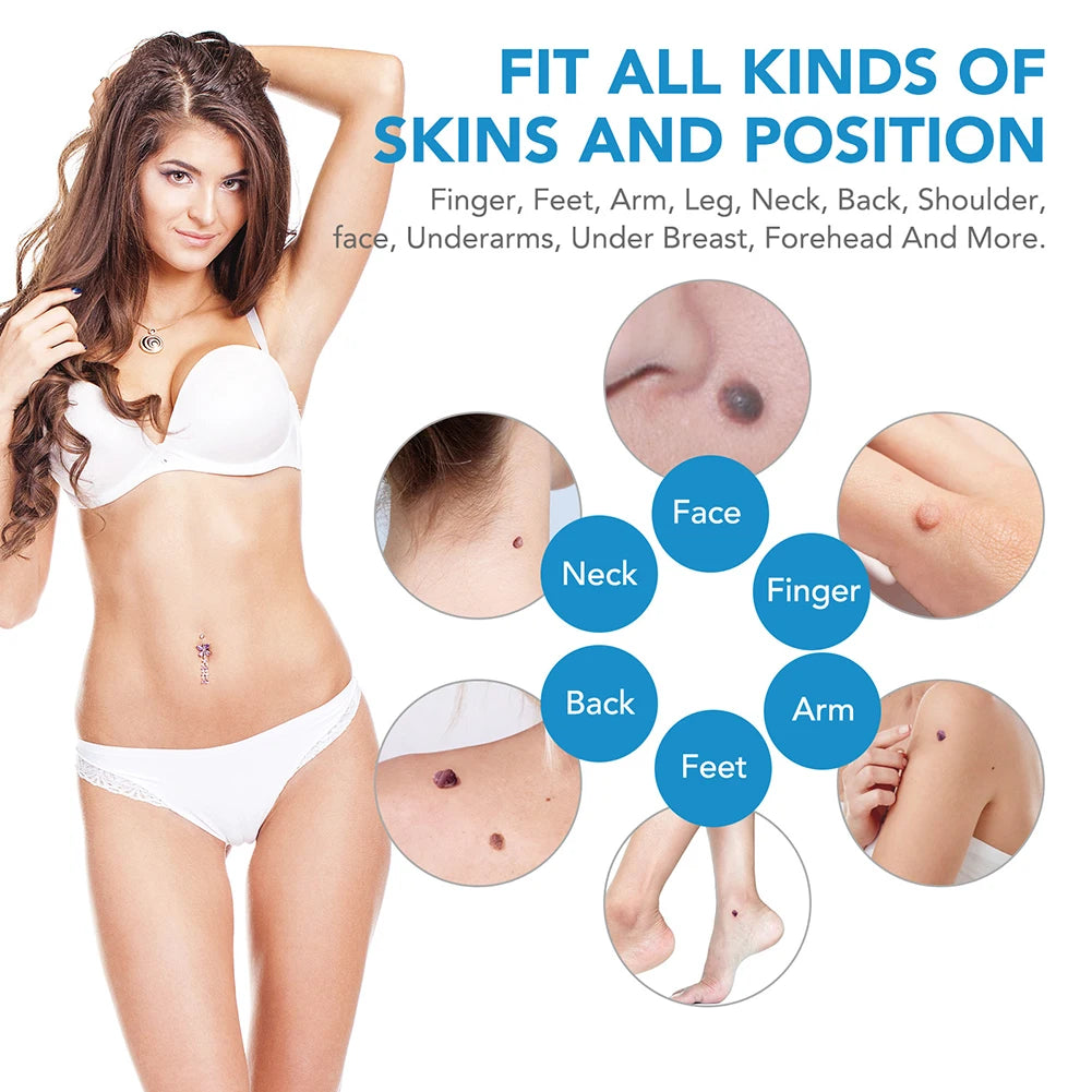 Auto Micro Skin Tag Remover Device 2 IN 1 Standard And Micro Skin Tag Removal Kit Adult Mole Wart Remover Face Care Beauty Tools