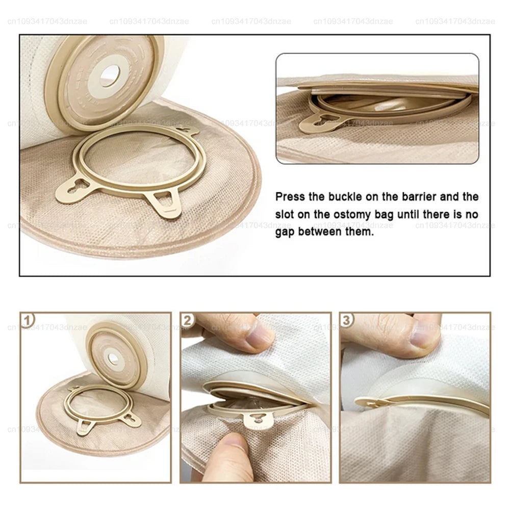 10 bags / 5 barriers Ostomy Supplies Colostomy Bags Two Piece Drainable Pouches with hoop and look Ileostomy Stoma Care