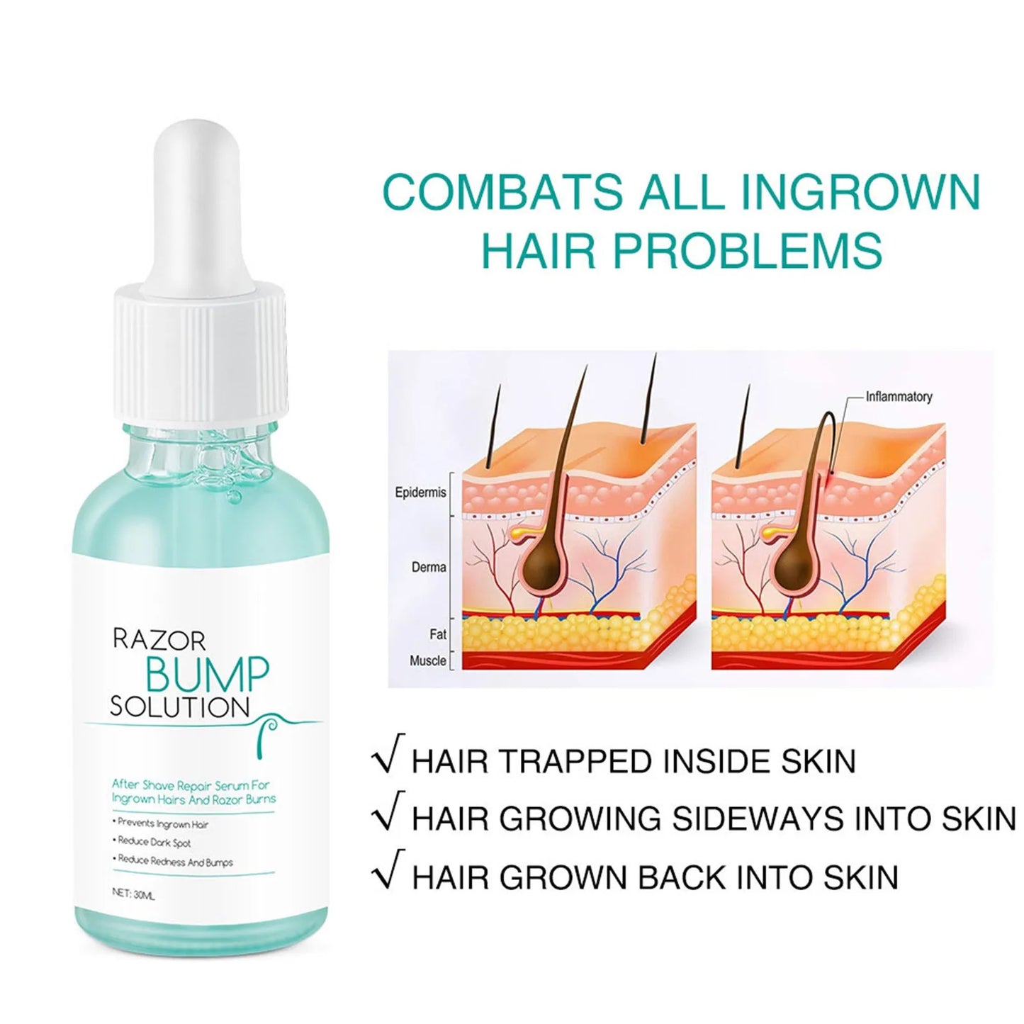 Anti-Ingrown Hair Gentle Serum 30ml Repaired Serum Redness Bumps Ingrown Hair After Shaving Prevent Hair Growth Serum Post-Shave