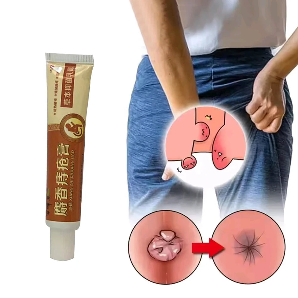 New Musk Materials Hemorrhoids Ointment Powerful Hemorrhoids Cream Internal Hemorrhoids Piles External Anal Pain Relief Cream