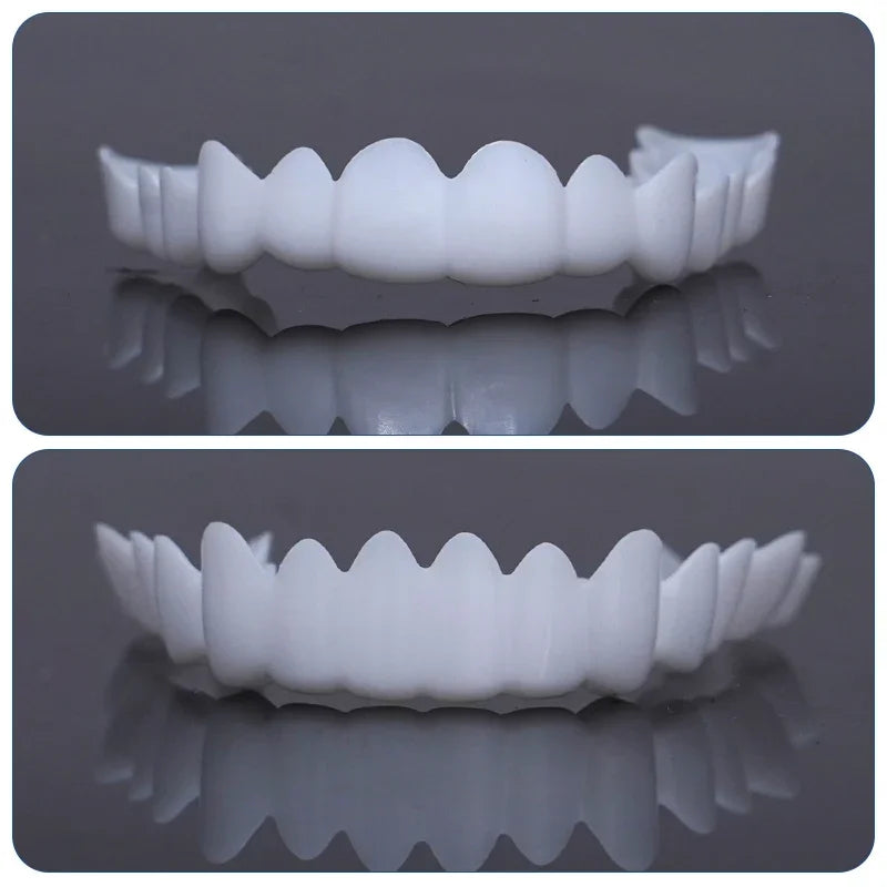 Sdottor Dental Perfect Fit Teeth Whitening Fake Tooth Cover Adjustable Temporary Resin False Braces Snap On Smile Veneers Prosth