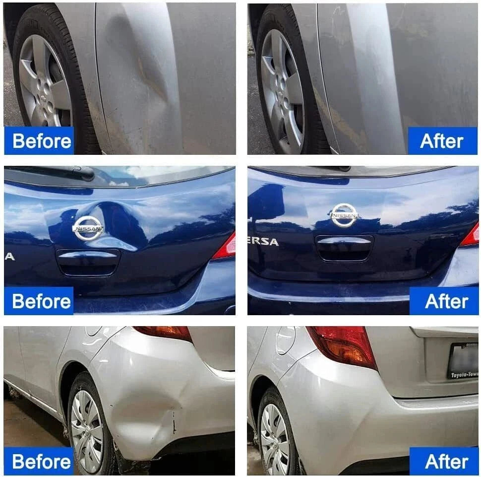 Super PDR Paintless Dent Repair Tool Set Professional Car Body Dent Repair Kit Suction Cup Dent Puller Dent Removal Repair Tool