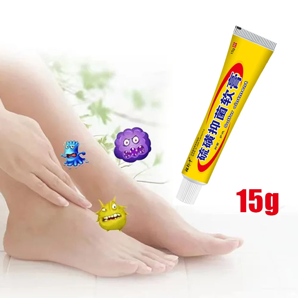 Sulfur Antibacterial Cream Soap Spray Set Psoriasis Eczema Anti-itch Relief Rash Urticaria Desquamation Ointment Body Skin Care