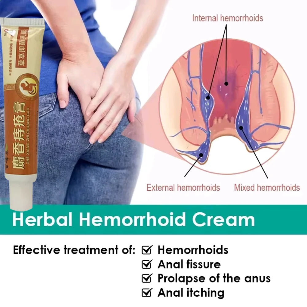 New Musk Materials Hemorrhoids Ointment Powerful Hemorrhoids Cream Internal Hemorrhoids Piles External Anal Pain Relief Cream