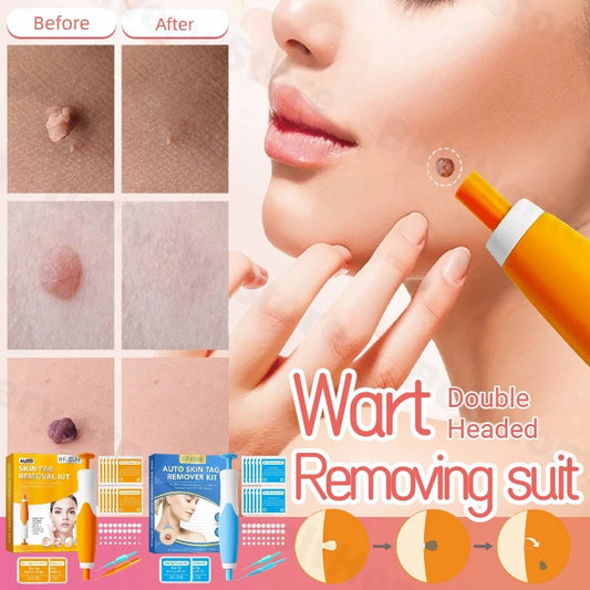 Auto Micro Skin Tag Remover Device 2 IN 1 Standard And Micro Skin Tag Removal Kit Adult Mole Wart Remover Face Care Beauty Tools