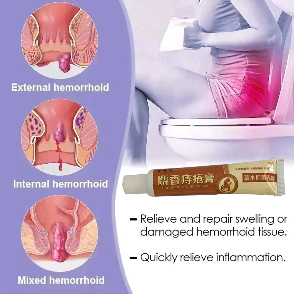 New Musk Materials Hemorrhoids Ointment Powerful Hemorrhoids Cream Internal Hemorrhoids Piles External Anal Pain Relief Cream